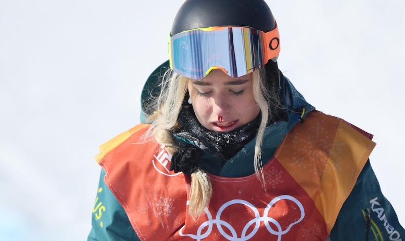After Emily Arthur’s fall, athlete was shaken but not defeated. NBC Sports