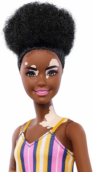This brand-new Barbie represents a woman living with vitiligo.