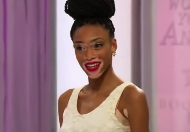Winnie Harlow made a name for herself as a contestant on “America’s Next Top Model” competition show. Photo courtesy of Anisa Productions/Pottle Productions/The Tyra Banks Company